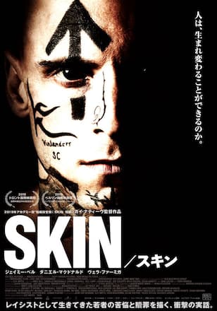 SKIN/スキン